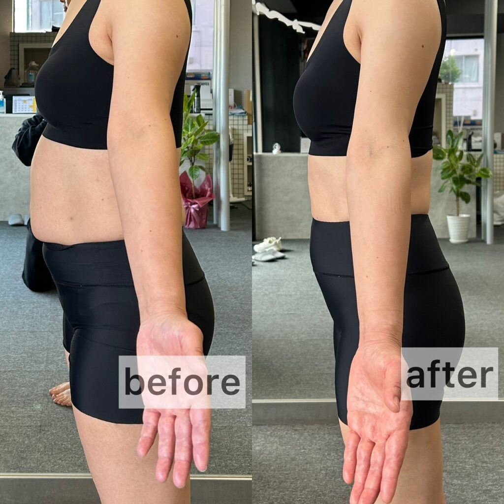 女性でダイエットに成功された方の画像
